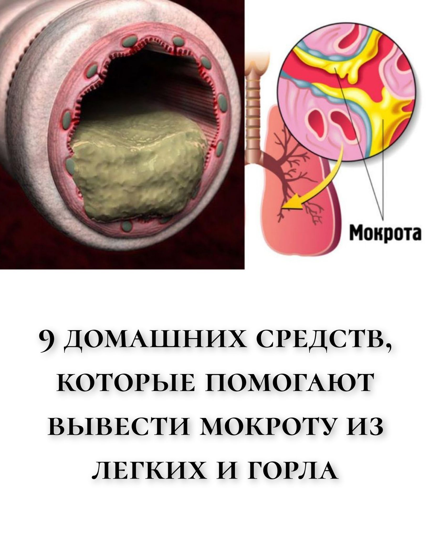9 домашних средств, которые помогают вывести мокроту из легких и горла