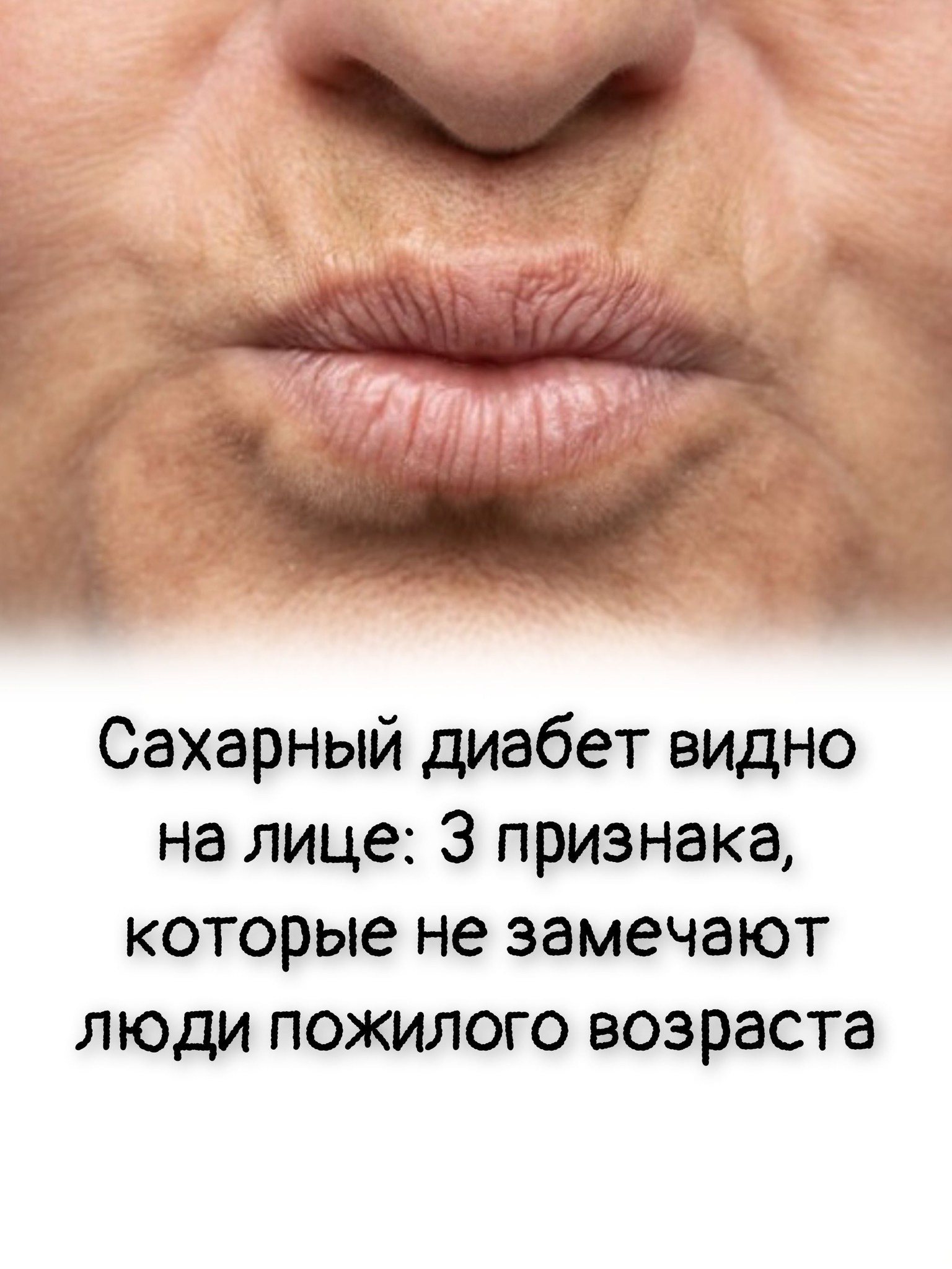 Сахарный диабет видно на лице: 3 признака, которые не замечают люди пожилого возраста