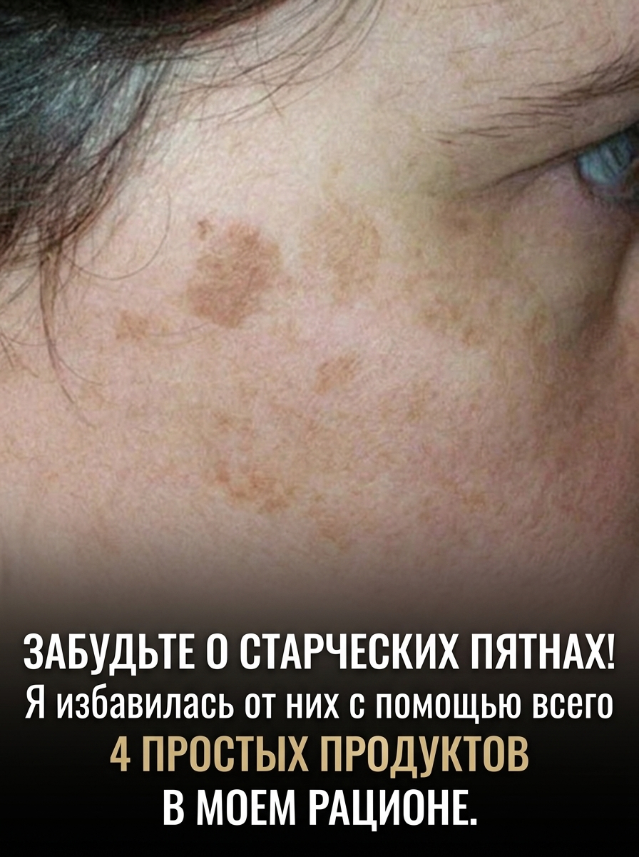Как победить возрастную пигментацию с помощью питания
