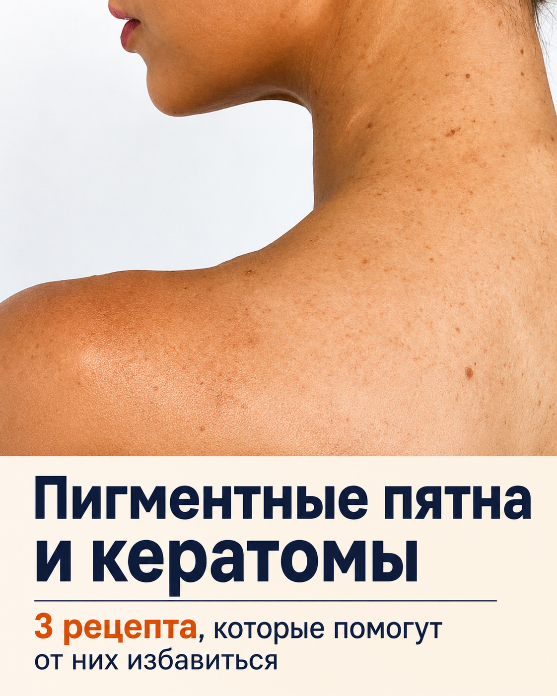 Как избавиться от пигментных пятен и кератом в домашних условиях